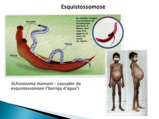 Schistosoma mansoni – causador da
esquistossomose (“barriga d’água”)
Esquistossomose
 