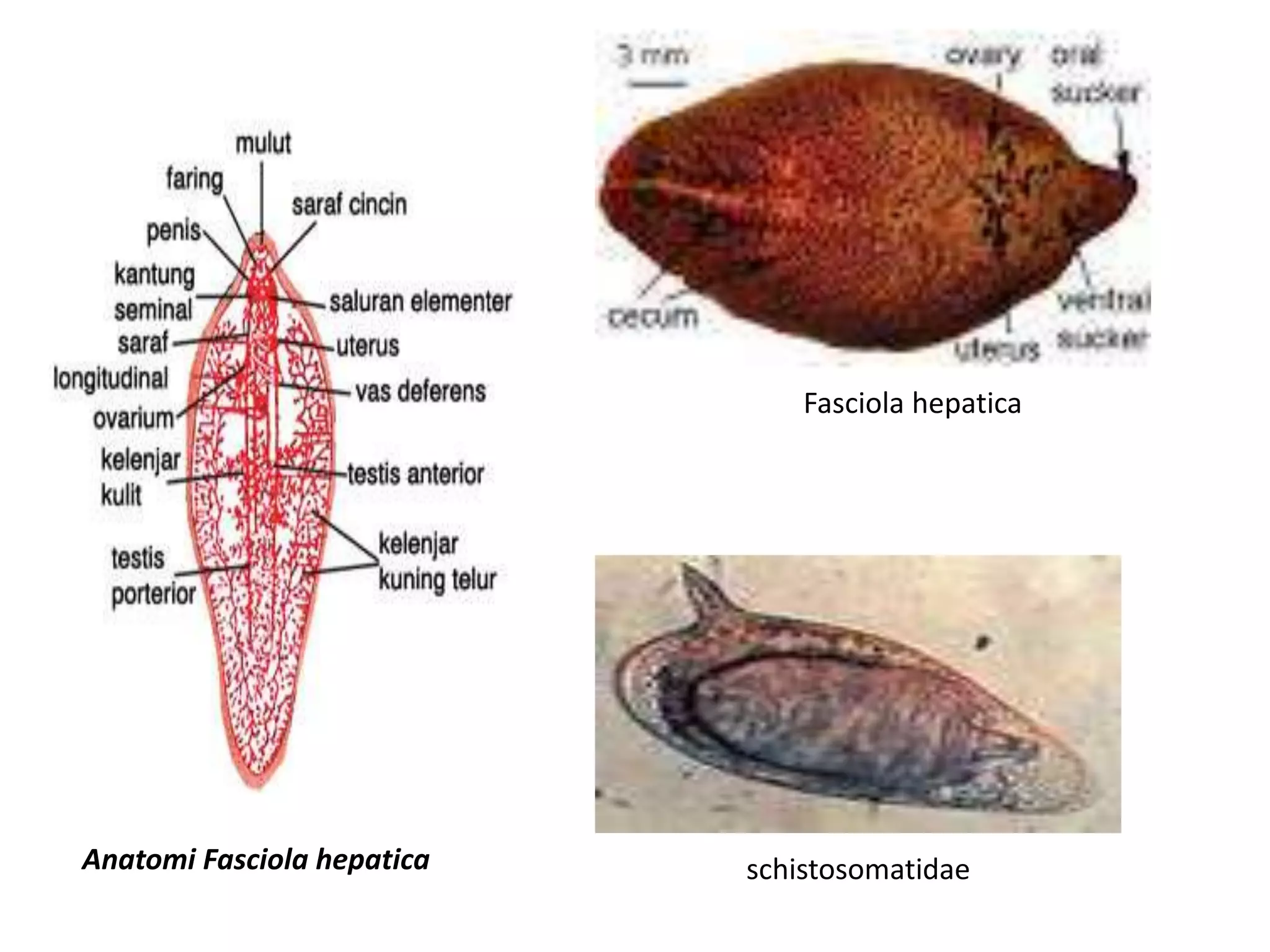 schistosomatidae
Fasciola hepatica
Anatomi Fasciola hepatica
 