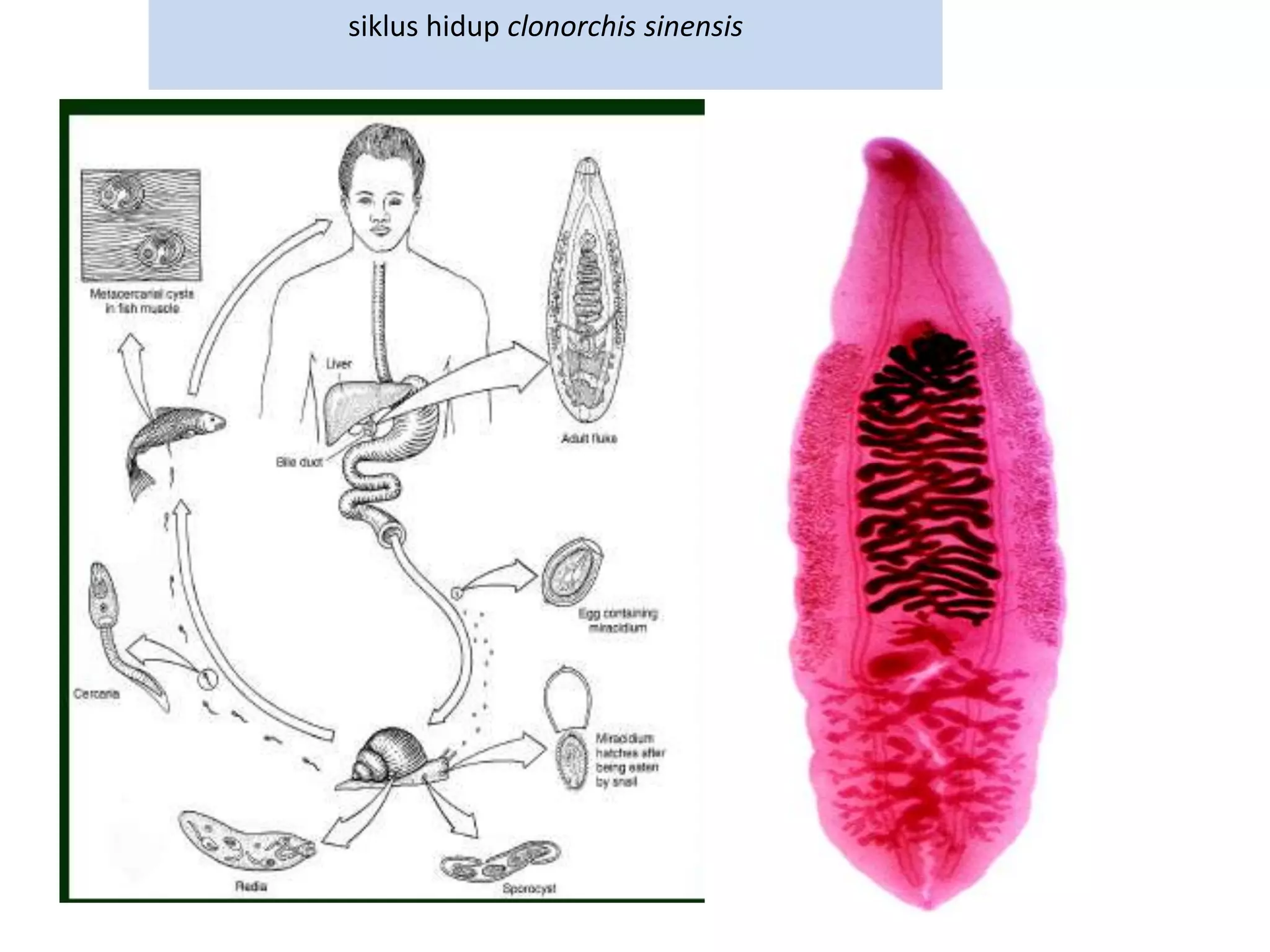 siklus hidup clonorchis sinensis
 