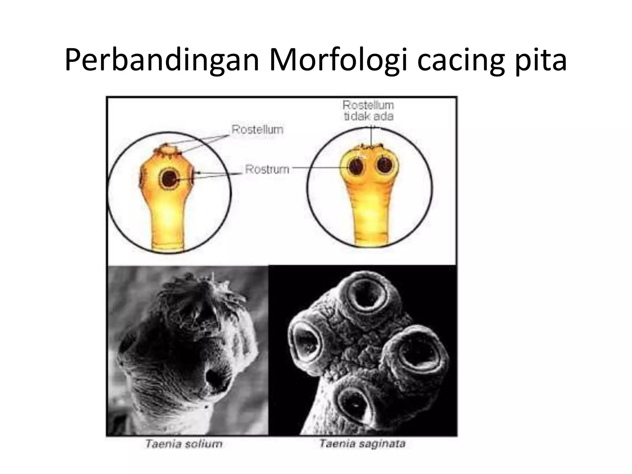 Perbandingan Morfologi cacing pita
 