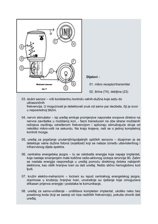 Dijelovi :
01. mikro receptor/transmiter
02. širina (74), debljina (23)
03. slušni senzor – vrši kontstantnu kontrolu valnih-dužina koje sežu do
ultrasoničnih
frekvencija. U mogućnosti je detektovati zvuk od samo par decibela, čiji je izvor
u neposrednoj blizini.
04. nervni stimulator – taj uređaj emituje promjenjive naponske snopove direkno na
nervne završetke u moždanoj kori, - fazni transduceri na obe strane moždanih
režnjeva osciliraju određenom frekvencijom i apliciraju stimulirajuće struje od
nekoliko mikro-volti na sekundu. Na kraju krajeva, radi se o jednoj kompletnoj
kontroli mozga.
05. uređaj za pojačanje unutarnjih/spoljašnjih optičkih senzora – dizajniran je da
detektuje valne dužine fotona (svjetlosti) koji se nalaze između ultaviolentnog i
infracrvenog dijela spektra.
06. centralna energetska jezgra – tu se oslobađa energija koja napaja implantat,
koja nastaje smanjenjem male količine radio-aktivnog izotopa stroncija 90. Zatim
se nastala energija raspoređuje u uređaj pomoću direktnog dotoka nabijenih
elektrona, kao oblik hranjive tvari za dati uređaj. Nešto slično hemoglobinu kod
ljudi.
07. kružni elektro-mehanizmi – locirani su ispod centralnog energetskog jezgra,
doprinose u kruženju hranjive tvari, unutrašnje su rješenje koje omogućava
efikasan prijenos energije i podataka te komunikacje.
08. uređaj za samo-uništenje - uništitava kompletan implantat, ukoliko neko bez
posebnog koda (koji se sastoji od niza različitih frekvencija), pokuša otvoriti dati
uređaj.
 