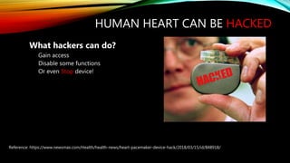 HUMAN HEART CAN BE HACKED
What hackers can do?
Gain access
Disable some functions
Or even Stop device!
Reference: https://www.newsmax.com/Health/health-news/heart-pacemaker-device-hack/2018/03/15/id/848918/
 