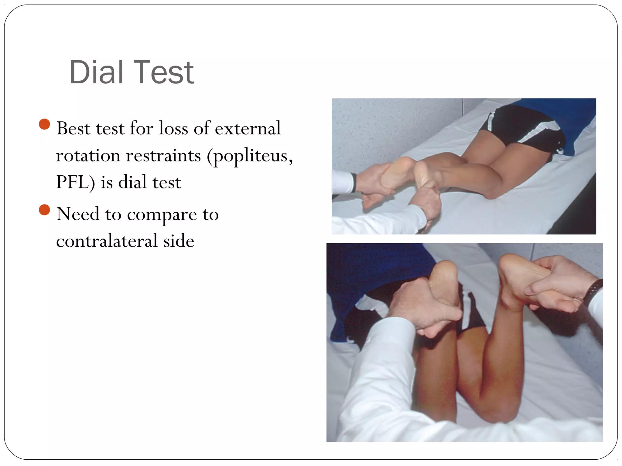 Dial Test Posterolateral corner injuries of knee joint | PPT