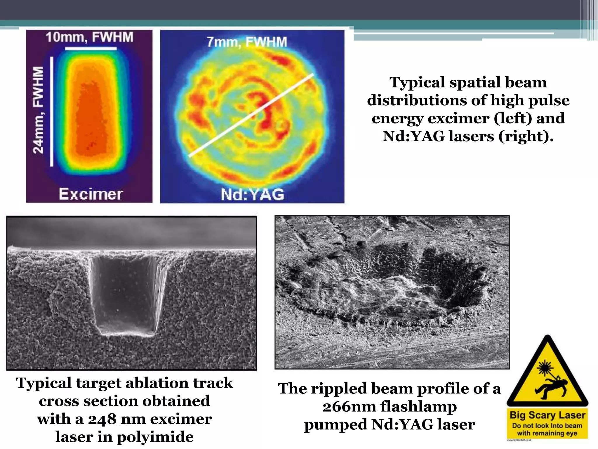 Typical spatial beam
distributions of high pulse
energy excimer (left) and
Nd:YAG lasers (right).
The rippled beam profile of a
266nm flashlamp
pumped Nd:YAG laser
Typical target ablation track
cross section obtained
with a 248 nm excimer
laser in polyimide
 