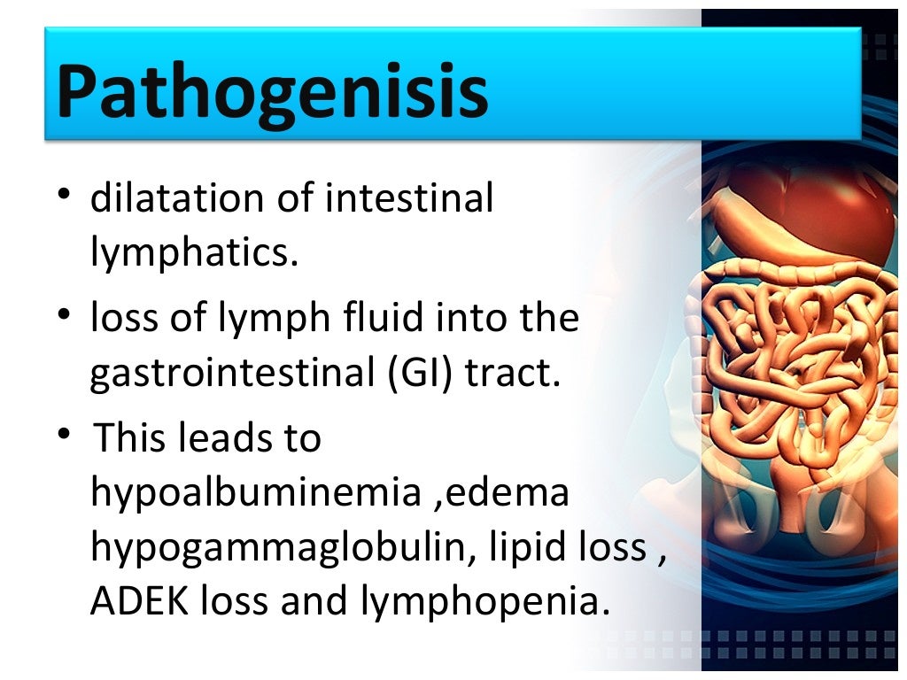 protein loosing enteropathy