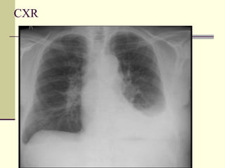 CXR
 
