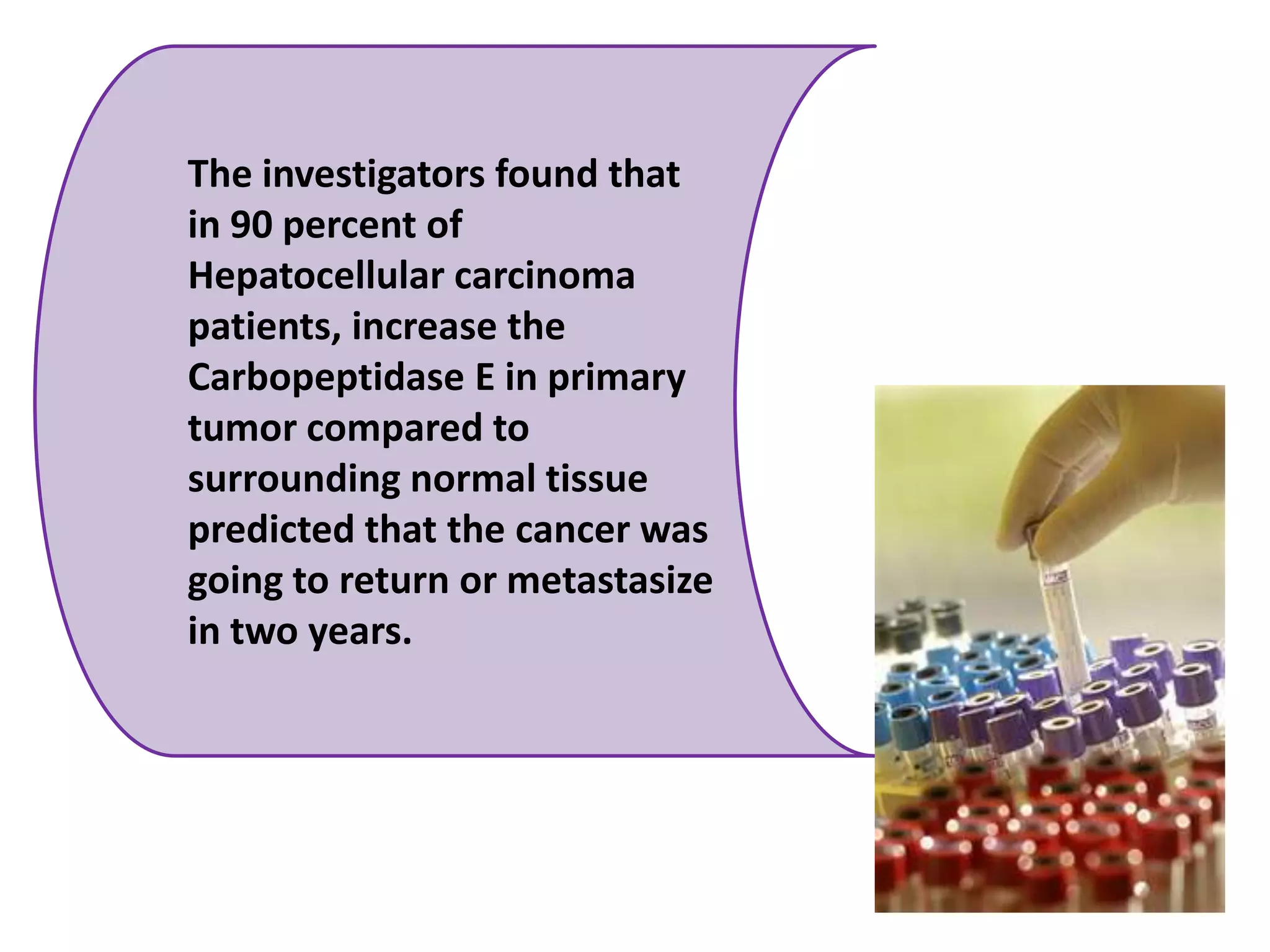 The investigators found that in 90 percent of Hepatocellular carcinoma patients, increase the Carbopeptidase E in primary tumor compared to surrounding normal tissue predicted that the cancer was going to return or metastasize in two years. 