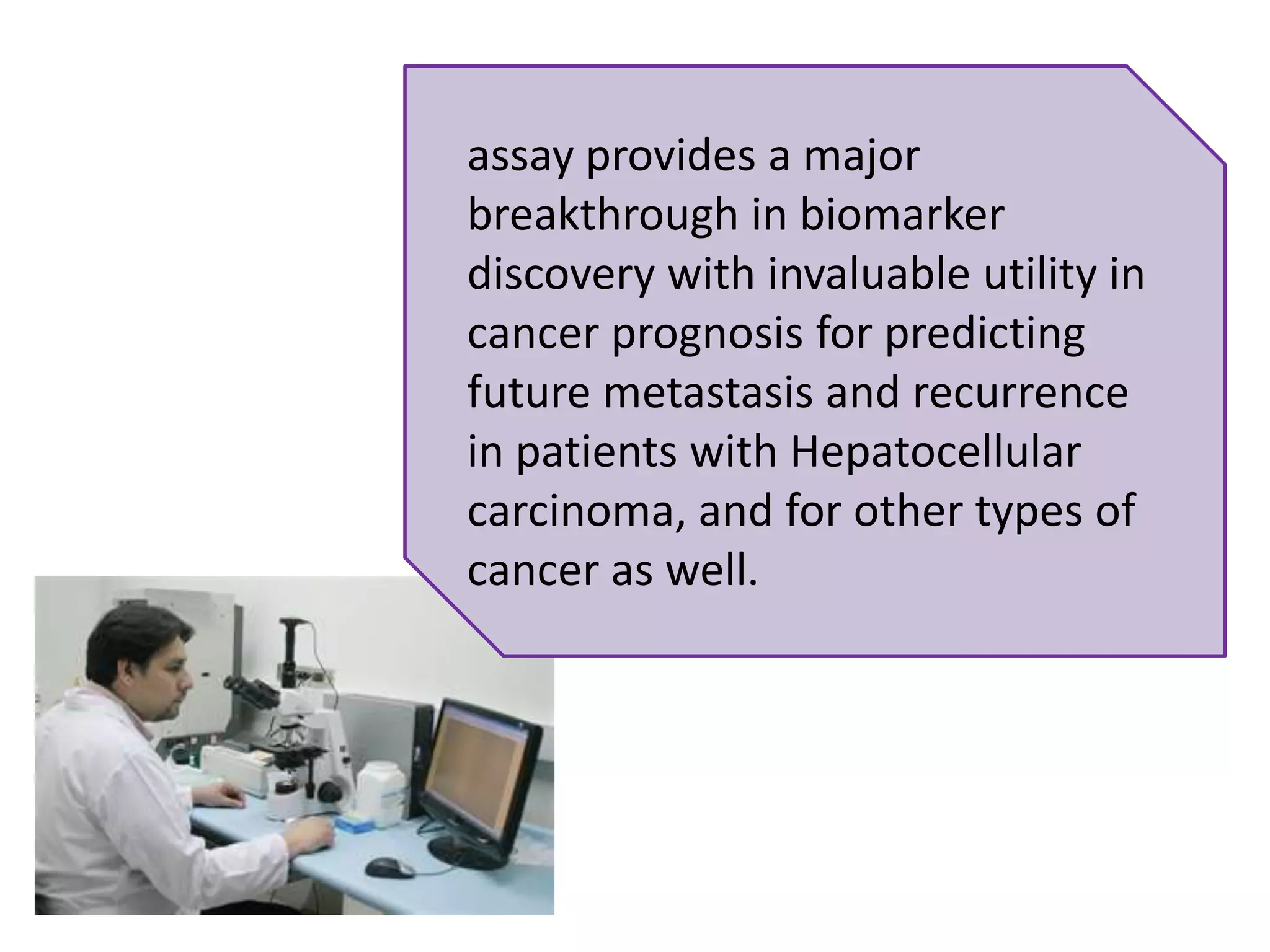 assay provides a major breakthrough in biomarker discovery with invaluable utility in cancer prognosis for predicting future metastasis and recurrence in patients with Hepatocellular carcinoma, and for other types of cancer as well.