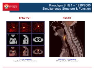 PET/MRI Current & Future Status | PDF