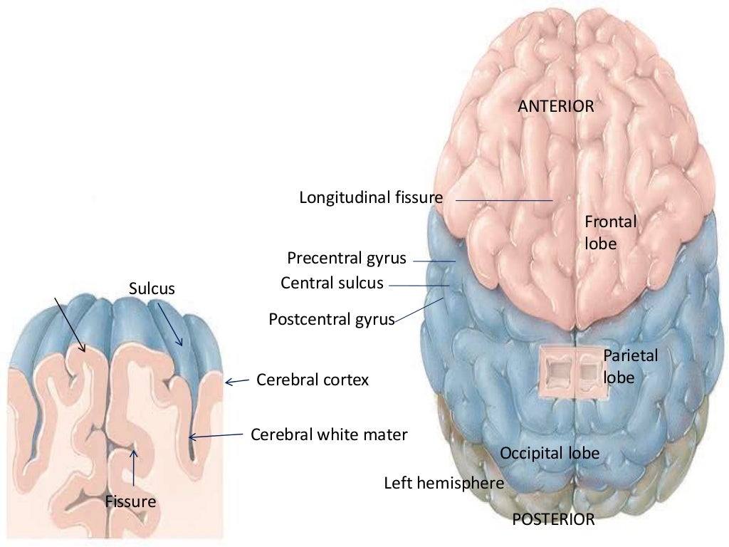 hemiparesis
