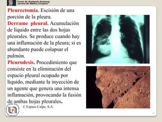 “Curso de Anatomía Humana:
     carrera de Médico Cirujano”


Pleurectomía. Escisión de una
porción de la pleura.
Derrame pleural. Acumulación
de líquido entre las dos hojas
pleurales. Se produce cuando hay
una inflamación de la pleura; si es
abundante puede colapsar el
pulmón.
Pleurodesis. Procedimiento que
consiste en la eliminación del
espacio pleural ocupado por
líquido, mediante la inyección de
un agente que genera una intensa
inflamación, provocando la fusión
de ambas hojas pleurales.
         © Espasa Calpe, S.A.
                                      24
 