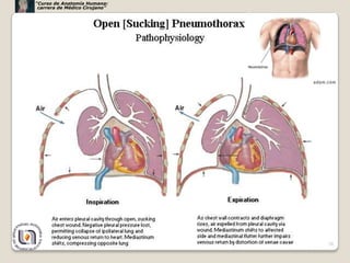 “Curso de Anatomía Humana:
 carrera de Médico Cirujano”




                               26
 