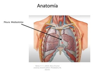 Anatomía
Pleura Mediastiníca
Netter, F. H. 1. (2019). Atlas of human
anatomy. Seventh edition. Philadelphia, PA,
Elsevier.
 