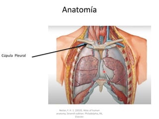 Anatomía
Cúpula Pleural
Netter, F. H. 1. (2019). Atlas of human
anatomy. Seventh edition. Philadelphia, PA,
Elsevier.
 