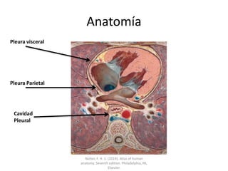 Anatomía
Pleura visceral
Pleura Parietal
Cavidad
Pleural
Netter, F. H. 1. (2019). Atlas of human
anatomy. Seventh edition. Philadelphia, PA,
Elsevier.
 