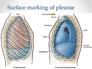 Surface marking of pleurae
 