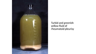 Pleural and Ascitic Fluids_Dr Swati Diwakar.pptx