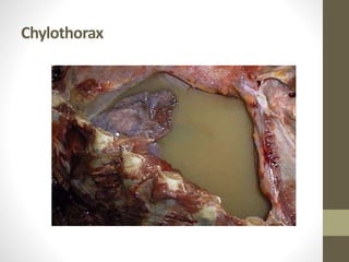 Chylothorax
 