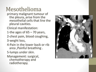 Mesothelioma
primary malignant tumour of
the pleura,.arise from the
mesothelial cells that line the
pleural cavities.
Clinical manifestation:
1-the ages of 65 – 70 years,
2-chest pain, blood coughing,
3-weght loss,
4-Pain in the lower back or rib
area ,Painful breathing .
5-lumps under skin.
Management: surgical,
chemotherapy and
radiotherapy.
 