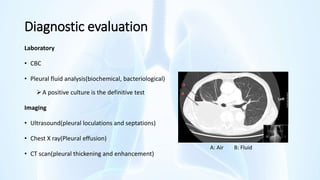 Diagnostic evaluation
Laboratory
• CBC
• Pleural fluid analysis(biochemical, bacteriological)
A positive culture is the definitive test
Imaging
• Ultrasound(pleural loculations and septations)
• Chest X ray(Pleural effusion)
• CT scan(pleural thickening and enhancement)
A: Air B: Fluid
 
