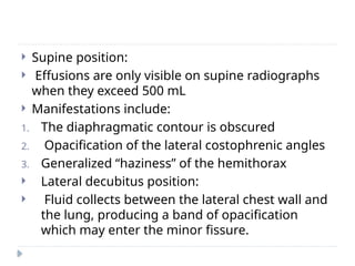  Supine position:
 Effusions are only visible on supine radiographs
when they exceed 500 mL
 Manifestations include:
1. The diaphragmatic contour is obscured
2. Opacification of the lateral costophrenic angles
3. Generalized “haziness” of the hemithorax
 Lateral decubitus position:
 Fluid collects between the lateral chest wall and
the lung, producing a band of opacification
which may enter the minor fissure.
 