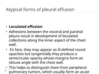 Atypical forms of pleural effusion
 Loculated effusion:
 Adhesions between the visceral and parietal
pleura result in development of loculated
collections along the inner aspect of the chest
wall.
 En face, they may appear as ill-defined round
opacities but tangentially they produce a
semicircular opacity whose margins form an
obtuse angle with the chest wall.
 This helps to distinguish them from peripheral
pulmonary tumors, which usually form an acute
 