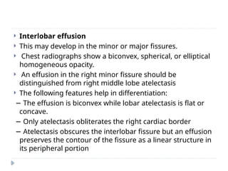  Interlobar effusion
 This may develop in the minor or major fissures.
 Chest radiographs show a biconvex, spherical, or elliptical
homogeneous opacity.
 An effusion in the right minor fissure should be
distinguished from right middle lobe atelectasis
 The following features help in differentiation:
− The effusion is biconvex while lobar atelectasis is flat or
concave.
− Only atelectasis obliterates the right cardiac border
− Atelectasis obscures the interlobar fissure but an effusion
preserves the contour of the fissure as a linear structure in
its peripheral portion
 