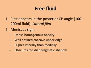 Free fluid
1. First appears in the posterior CP angle (100-
   200ml fluid): Lateral film
2. Meniscus sign:
  –   Dense homogenous opacity
  –   Well defined concave upper edge
  –   Higher laterally than medially
  –   Obscures the diaphragmatic shadow
 