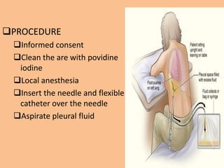 PROCEDURE
 Informed consent
 Clean the are with povidine
  iodine
 Local anesthesia
 Insert the needle and flexible
  catheter over the needle
 Aspirate pleural fluid
 