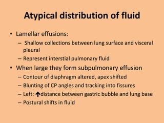 Atypical distribution of fluid
• Lamellar effusions:
  – Shallow collections between lung surface and visceral
    pleural
  – Represent interstial pulmonary fluid
• When large they form subpulmonary effusion
  –   Contour of diaphragm altered, apex shifted
  –   Blunting of CP angles and tracking into fissures
  –   Left: distance between gastric bubble and lung base
  –   Postural shifts in fluid
 