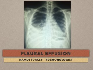 PLEURAL EFFUSION
HAMDI TURKEY - PULMONOLOGIST
 