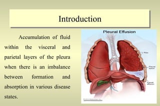 Introduction
Accumulation of fluid
within the visceral and
parietal layers of the pleura
when there is an imbalance
between formation and
absorption in various disease
states.
 