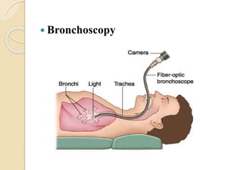  Bronchoscopy
 