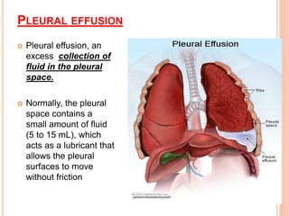 PLEURAL EFFUSION
 Pleural effusion, an
excess collection of
fluid in the pleural
space.
 Normally, the pleural
space contains a
small amount of fluid
(5 to 15 mL), which
acts as a lubricant that
allows the pleural
surfaces to move
without friction
 
