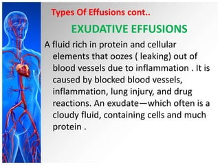 Types Of Effusions cont..
EXUDATIVE EFFUSIONS
A fluid rich in protein and cellular
elements that oozes ( leaking) out of
blood vessels due to inflammation . It is
caused by blocked blood vessels,
inflammation, lung injury, and drug
reactions. An exudate—which often is a
cloudy fluid, containing cells and much
protein .
 