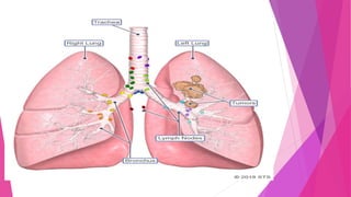 PLEURAL EFFUSION.pptx