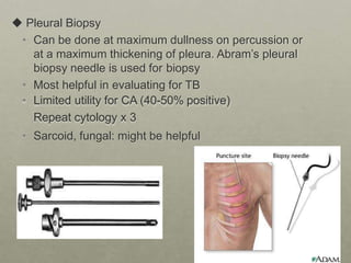  Pleural Biopsy
• Can be done at maximum dullness on percussion or
at a maximum thickening of pleura. Abram’s pleural
biopsy needle is used for biopsy
• Most helpful in evaluating for TB
• Limited utility for CA (40-50% positive)
Repeat cytology x 3
• Sarcoid, fungal: might be helpful
 