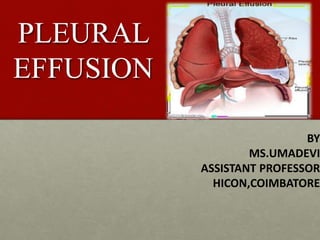 BY
MS.UMADEVI
ASSISTANT PROFESSOR
HICON,COIMBATORE
PLEURAL
EFFUSION
 