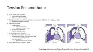 Tension Pneumothorax
• Injury acts as one-way valve
• Air can enter pleural space
• Air cannot exit pleural space
• During inspiration, negative intrapleural pressure sucks additional air into pleural space
• Intrathoracic pressure increases
• Sequence of events
• Lung collapses
• Vital capacity decreases
• Respiratory exchange decreases
• Venous return decreases
• Cardiac output decreases
• As tension pneumo worsens:
• Ipsilateral diaphragm is depressed
• Mediastinum is pushed into contralateral lung
• Gas exchange further impaired
• SVC / IVC can kink
• Worsening venous return / perfusion
• Result: hypotension / shock & death
http://www.fprmed.com/Pages/Trauma/Tension_Pneumothorax.html
 
