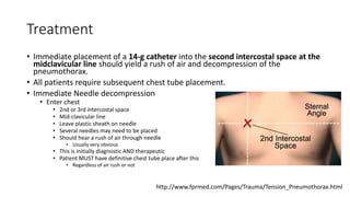 Treatment
• Immediate placement of a 14-g catheter into the second intercostal space at the
midclavicular line should yield a rush of air and decompression of the
pneumothorax.
• All patients require subsequent chest tube placement.
• Immediate Needle decompression
• Enter chest
• 2nd or 3rd intercostal space
• Mid-clavicular line
• Leave plastic sheath on needle
• Several needles may need to be placed
• Should hear a rush of air through needle
• Usually very obvious
• This is initially diagnostic AND therapeutic
• Patient MUST have definitive chest tube place after this
• Regardless of air rush or not
http://www.fprmed.com/Pages/Trauma/Tension_Pneumothorax.html
 