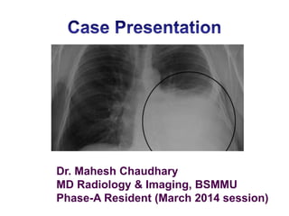 Dr. Mahesh Chaudhary
MD Radiology & Imaging, BSMMU
Phase-A Resident (March 2014 session)
 