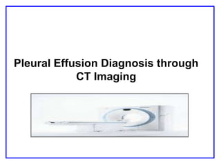 Pleural Effusion Diagnosis through
CT Imaging
 