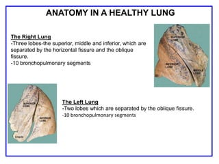 The Right Lung
-Three lobes-the superior, middle and inferior, which are
separated by the horizontal fissure and the oblique
fissure.
-10 bronchopulmonary segments
The Left Lung
-Two lobes which are separated by the oblique fissure.
-10 bronchopulmonary segments
ANATOMY IN A HEALTHY LUNG
 