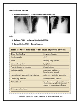 7 DR MAGDI AWAD SASI SIMPLE APPROACH TO PLEURAL EFFUSION 2014
Massive Pleural effusion
1. White out lung(WOL) + Contralateral Mediastinal shift
D/D:
1. Collapse (WOL + Ipsilateral Mediastinal Shift)
2. Consolidation (WOL + Central trachea)
 