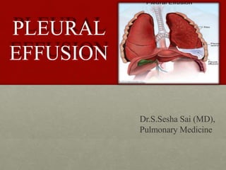 PLEURAL
EFFUSION
Dr.S.Sesha Sai (MD),
Pulmonary Medicine
 