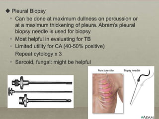  Pleural Biopsy
• Can be done at maximum dullness on percussion or
at a maximum thickening of pleura. Abram’s pleural
biopsy needle is used for biopsy
• Most helpful in evaluating for TB
• Limited utility for CA (40-50% positive)
Repeat cytology x 3
• Sarcoid, fungal: might be helpful
 