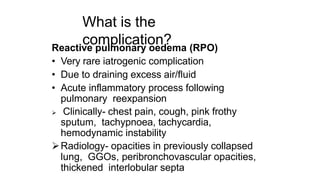 Chest Buckuy Rpo Pleural Effusion in Children-converted.pptx