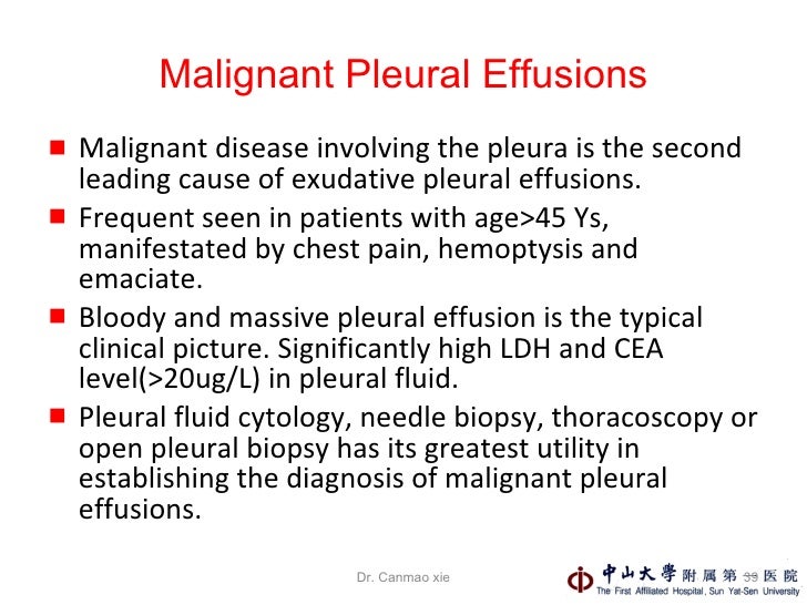 pleural-effusions