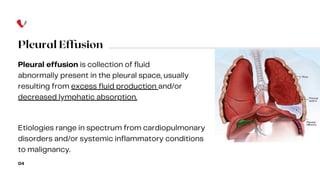 Pleural Effusion
Pleural effusion is collection of fluid
abnormally present in the pleural space, usually
resulting from excess fluid production and/or
decreased lymphatic absorption.
04
Etiologies range in spectrum from cardiopulmonary
disorders and/or systemic inflammatory conditions
to malignancy.
 