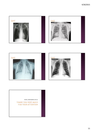 4/30/2015
11
noreen_mater@yahoo.com.au
 